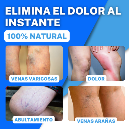 1+1 GRATIS VENOSPRAY™ | ELIMINA LAS VARICES EN 12 DÍAS