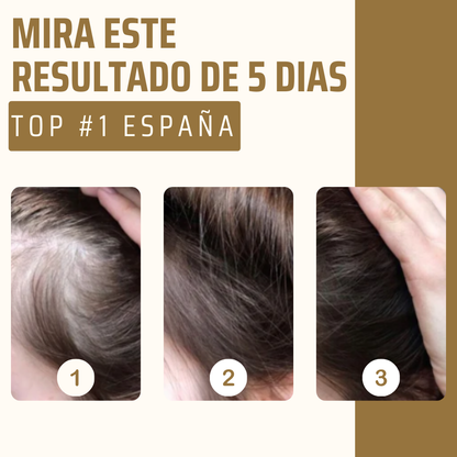 1+1 GRATIS GINGERMAX™ | CRECE TU CABELLO EN SÓLO 5 DÍAS