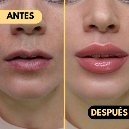 1+1 GRATIS KISSGLOW™ | ENGROSA TUS LABIOS HASTA 5 VECES SU TAMAÑO NATURAL